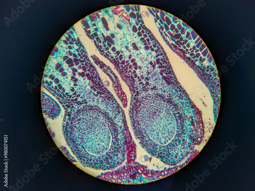 photo of archegonium tissue under the microscope photo