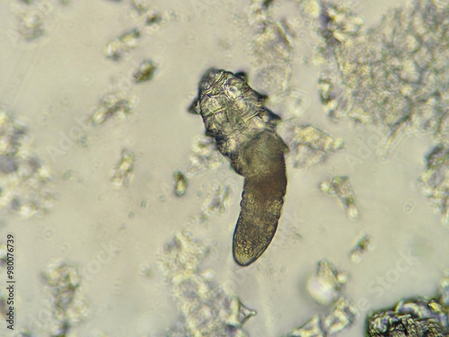 Canvastavla photo of demodex face mite under the microscope