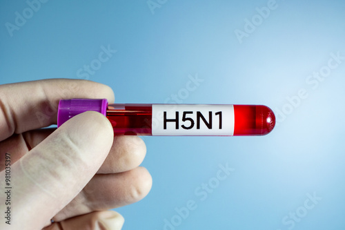 Blood collection tubes H5N1 bird flu test positive results,Medical health concept