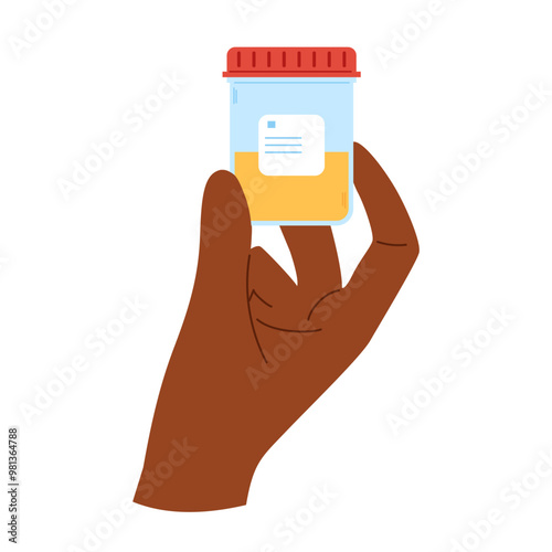 African hand holds container with pee sample inside. Medical urine sample in plastic container