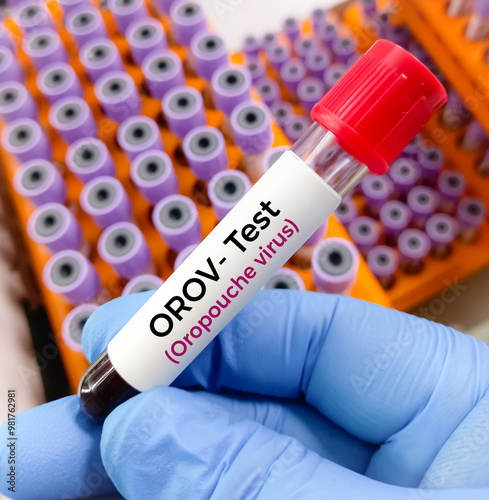 Blood sample for Oropouche virus Test to diagnosis of Oropouche virus disease or  Oropouche fever. It spreads the bite of midges (Culicoides paraensis) and certain mosquitos. Oropouche orthobunyavirus photo