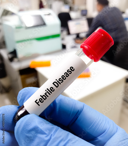 Blood sample for Febrile disease test, diagnosis of salmonellosis, brucellosis and rickettsia diseases. Febrile antigen test. photo