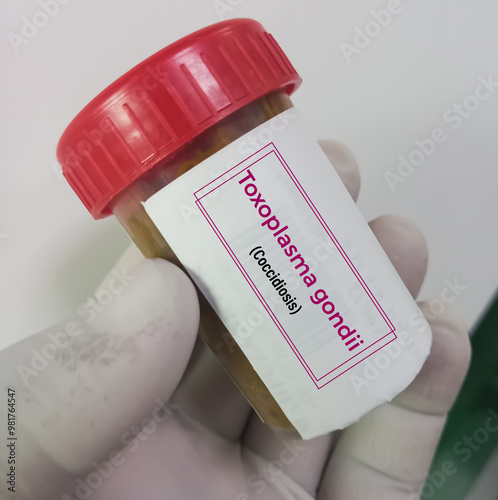 Stool sample for Coccidiosis test. toxoplasma gondii, toxoplasmosis photo