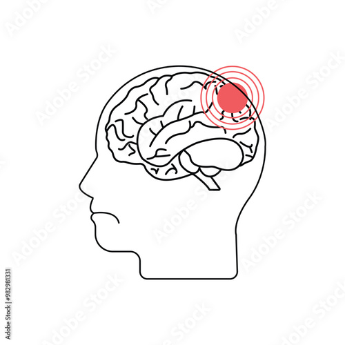 headache logo isolated on white. concept of tension migraine or brain symptom and head hurts point or bad personal emotion. linear flat style trend modern
