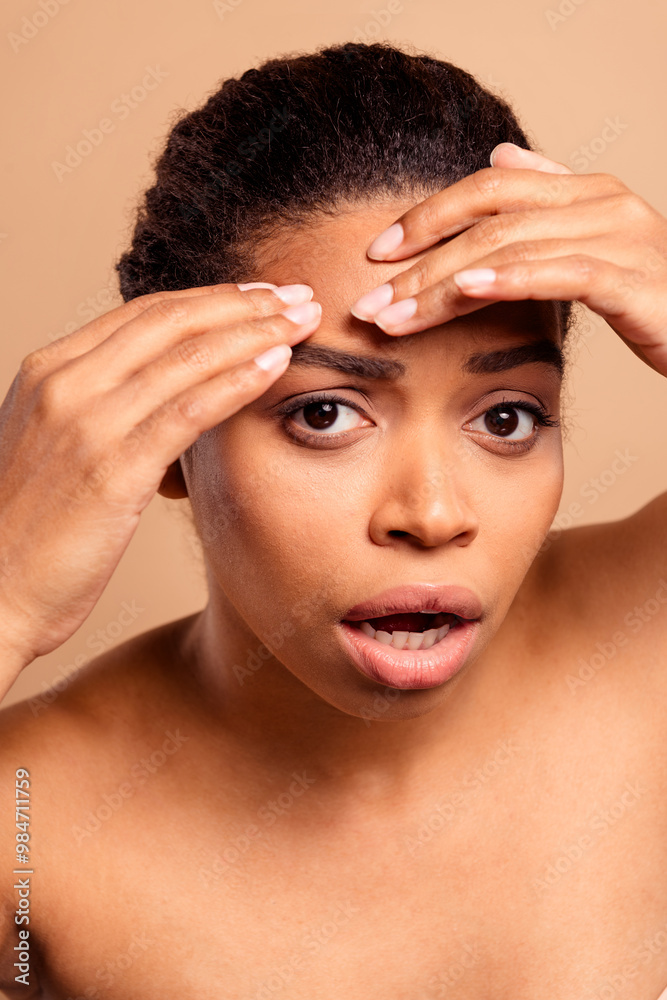Vertical photo of gorgeous cheerful woman skin problem pimple naked shoulders isolated on beige pastel color background Vertical photo of gorgeous cheerful woman skin problem pimple naked shoulders isolated on beige pastel color background