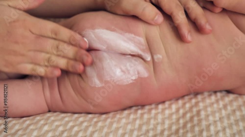 Close-up of a woman's hands applying cream to a baby's bottom. Special nappy cream. Maternal care for a newborn baby. The baby is lying on the changing table