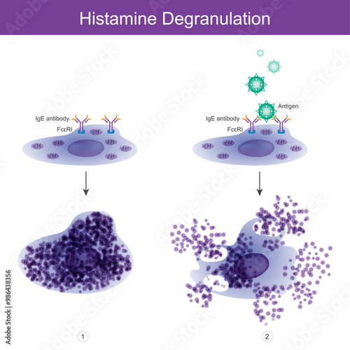 Histamine Degranulation. Histamine degranulation out of mast cell.
