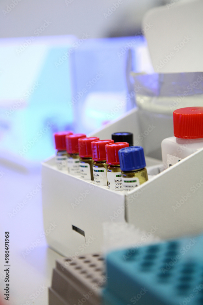 Tubes prepared in lab centrifuge machine blood, urine bank. Test tube in automate analyzer sample tray prepared in lab centrifuge machine. Testing hematology laboratory rack of flasks with labels in Tubes prepared in lab centrifuge machine blood, urine bank. Test tube in automate analyzer sample tray prepared in lab centrifuge machine. Testing hematology laboratory rack of flasks with labels in