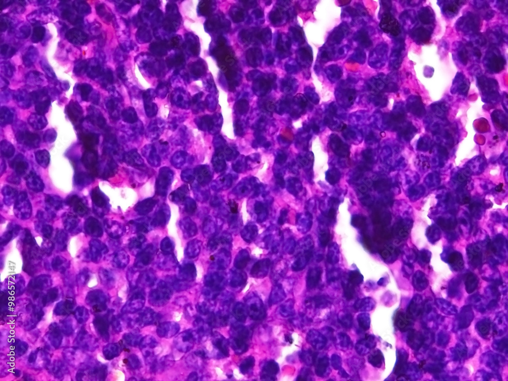 Microscopic View of Rat Spleen Histopathology: Germinal Center or white pulp at 400x Magnification Microscopic View of Rat Spleen Histopathology: Germinal Center or white pulp at 400x Magnification