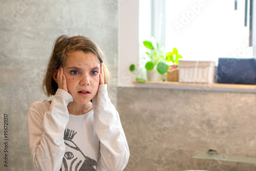 Natural vaccination. Contagious disease. Sick child with chickenpox. Varicella virus or Chickenpox bubble rash on child body and face. High quality photo.  photo