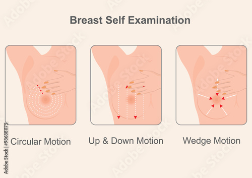 The three methods to perform a breast self-examination