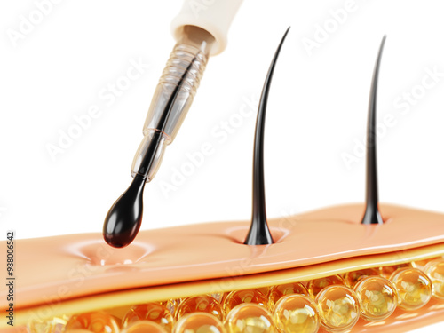 3d hair transplant fue method render banner. Scalp with follicles and medical instrument, implantation of graft in channel. Baldness treatment, transplantation and restoration concept. 3D illustration photo