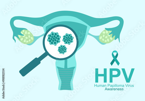 HPV (Human Papillomavirus) Cervical cancer awareness. Infection prevention, Doctor diagnosis HPV virus and vaccination medication treatment, women health concept.