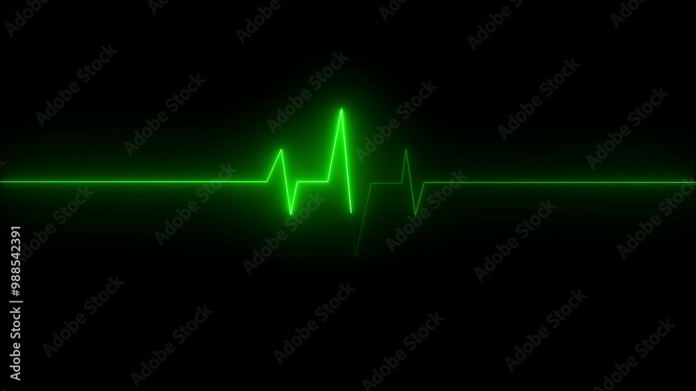Cardiogram cardiograph oscilloscope screen green Cardiogram cardiograph oscilloscope screen green