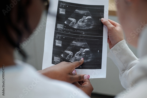 Healthcare professional holding and showing ultrasound images during prenatal checkup illustrating baby development and monitoring health progress without any medical apparatus in view photo