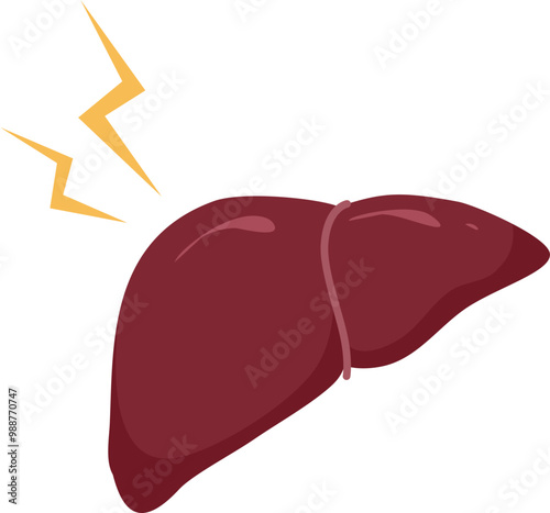 Liver disease illustration 
