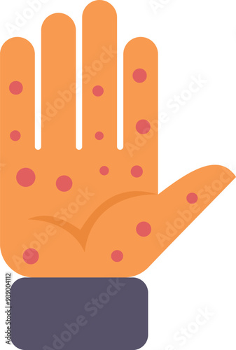 Illustration of a hand with a viral infectious disease, for medical and healthcare publications