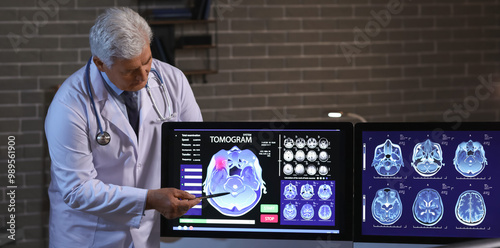Senior neurologist with MRI...