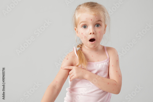 Shocked little girl ill wit...