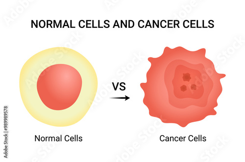 Normal Cells vs Cancer Cells