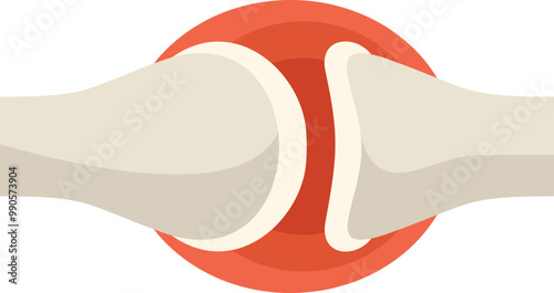 This illustration shows two bones connected by a joint, with a red area indicating inflammation and pain