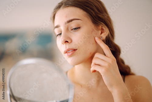 A young woman with problem skin is engaged in her skincare routine, gently touching her face while looking into a mirror in a well-lit, minimalist setting. Concept of acne therapy, scars, inflammation photo