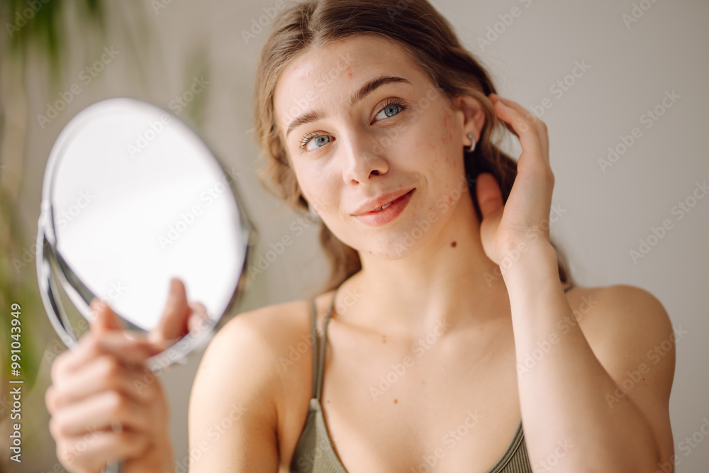 A young woman with problem skin is engaged in her skincare routine, gently touching her face while looking into a mirror in a well-lit, minimalist setting. Concept of acne therapy, scars, inflammation A young woman with problem skin is engaged in her skincare routine, gently touching her face while looking into a mirror in a well-lit, minimalist setting. Concept of acne therapy, scars, inflammation