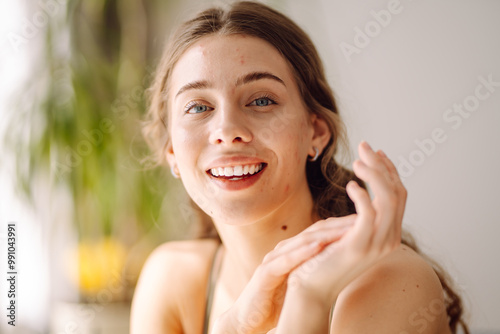 A young woman with problem skin is engaged in her skincare routine, gently touching her face while looking into a mirror in a well-lit, minimalist setting. Concept of acne therapy, scars, inflammation