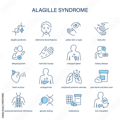 Alagille Syndrome symptoms, diagnostic and treatment vector icon set. Medical icons.	
