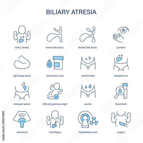 Biliary Atresia symptoms, diagnostic and treatment vector icon set. Medical icons.	