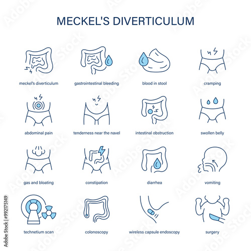 Meckel's Diverticulum symptoms, diagnostic and treatment vector icon set. Medical icons.	