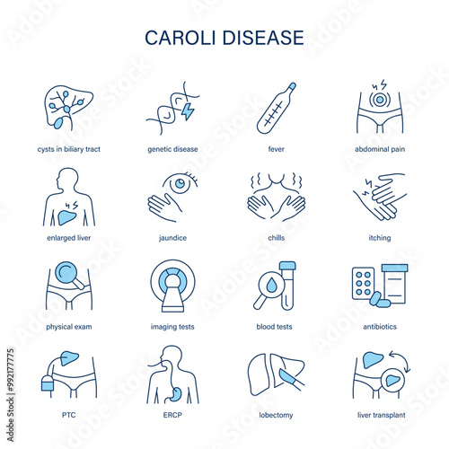 Caroli Disease symptoms, diagnostic and treatment vector icon set. Medical icons.	 photo