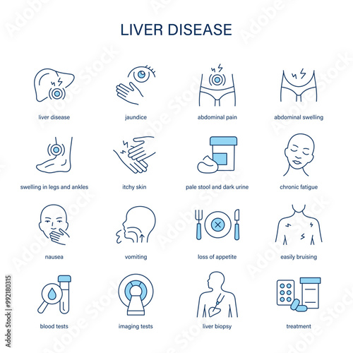 Liver Disease symptoms, diagnostic and treatment vector icon set. Medical icons.	