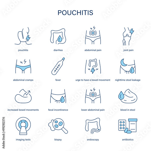 Pouchitis symptoms, diagnostic and treatment vector icon set. Medical icons.	 photo
