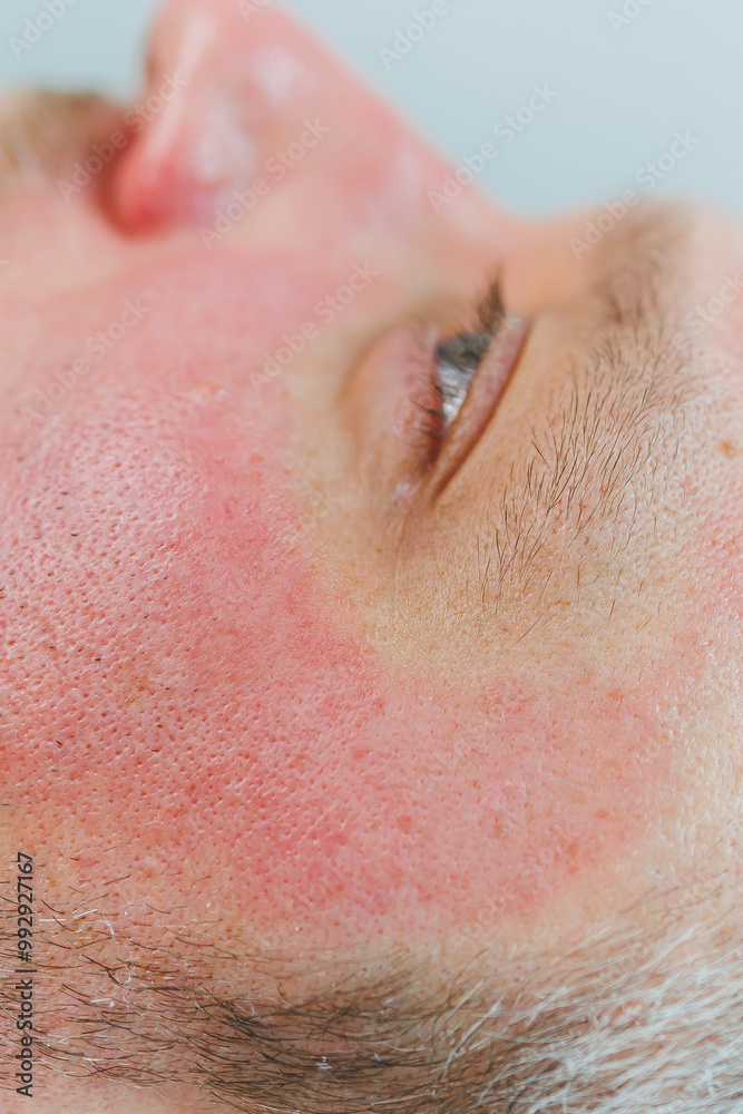 A cosmetologist cleans the skin of a man's face. A man does facial procedures in a cosmetic clinic. Male cosmetology. A cosmetologist cleans the skin of a man's face. A man does facial procedures in a cosmetic clinic. Male cosmetology.