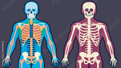 Diagram showing two human skeletons side-by-side: one blue and one red, used for educational purposes to depict variations in human anatomy.