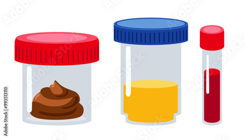 Medical samples in tubes. Laboratory Containers with Caps. Blood, urine and stool. Medical containers for assembling human biomaterial set. Healthcare, medical diagnostic Vector illustration.