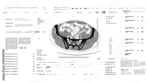 MRI x ray CT Scan. Medical HUD monitoring. Futuristic Technological Interface. Sceleton, 3D Model.Healthcare.white