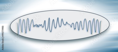 ECG image show torsades de pointes, illustration