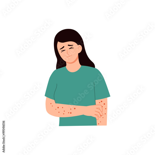 Chikungunya Symptoms in Adult 1 Rash