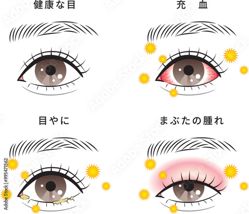 花粉が原因の目のトラブルセット