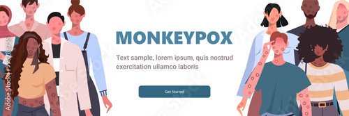  Monkeypox virus. The group of people is sick with smallpox and symptoms of monkeypox such as fever, rash, headache, swollen lymph node, rashes on face, body and back, muscle aches. Flat vector illust