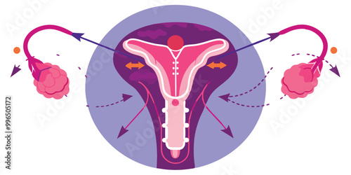 Create a vector illustration showing different hormonal contraceptive devices such as pills, patches, implants, and IUDs, arranged in a circular or grid format with brief labels.