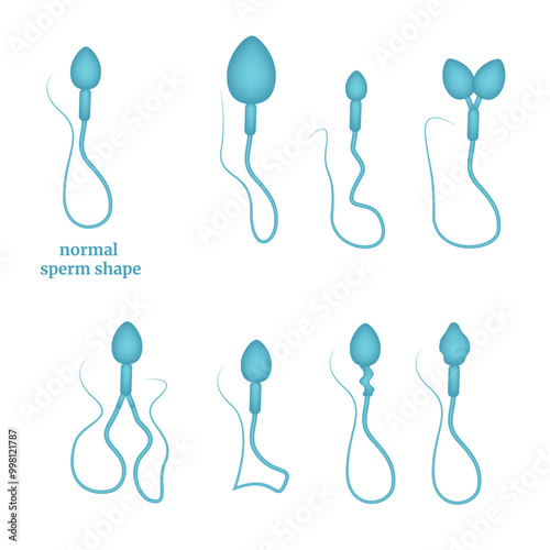 Types of sperm pathologies. Medical infographics. Vector