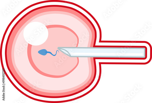 In Vitro fertilization IVF vector infographic and infertility treatment scheme with red line artificial insemination, embryo culture and cryopreservation. Medical procedure for pregnancy