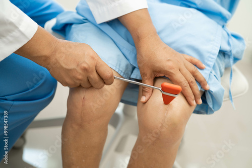 Doctor neurologist testing reflex knee with hammer and show Asian senior scars surgical total knee joint replacement.