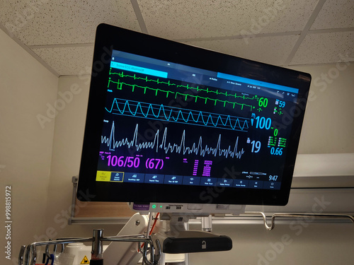 EKG, Pulse, BP and Respiration ICU Monitor Screen