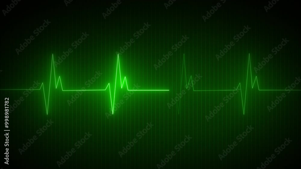 Blue neon Heart pulse monitor with signal. Heartbeat line. Flat line EKG, Pulse trace. EKG and Cardio symbol. Healthy and Medical concept Blue neon Heart pulse monitor with signal. Heartbeat line. Flat line EKG, Pulse trace. EKG and Cardio symbol. Healthy and Medical concept