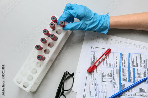 Doctor with HIV blood test ...