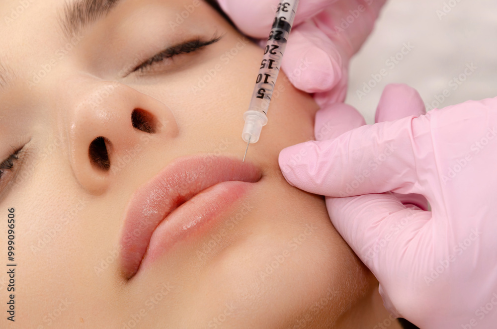 Young woman gets filler injection in her lips at a beauty salon. Lip augmentation procedure. Young woman gets filler injection in her lips at a beauty salon. Lip augmentation procedure.